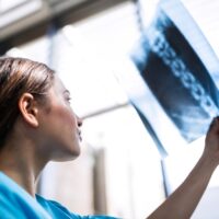A Herniated Disc is a Spinal Injury That May Stop You in Your Tracks